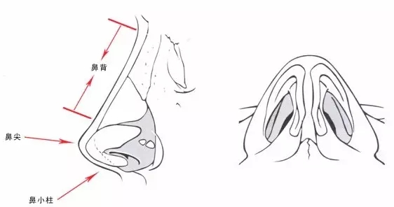 隆鼻失败后怎么修复