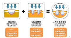 电波拉皮除皱价格需要多少？术后护理怎么护理？