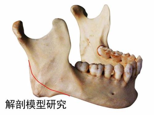 下颌骨整形手术价格