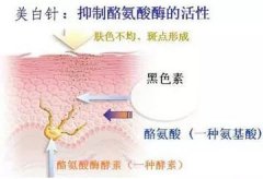 美白针都有着哪些功效呢