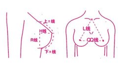 纠正乳房下垂的方式方法